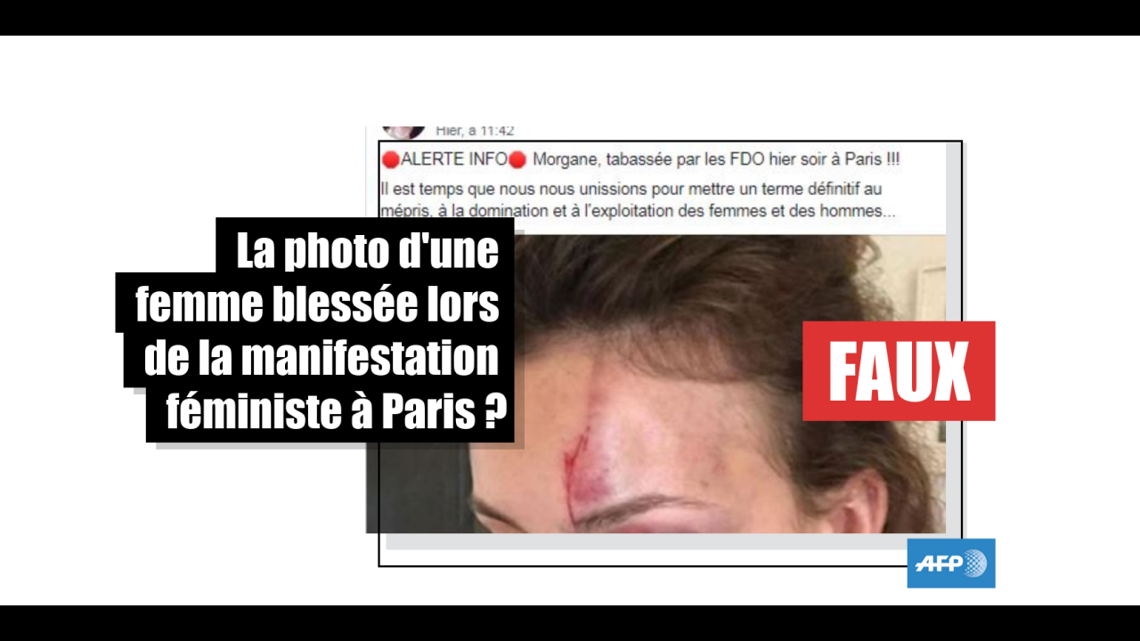 Non, cette photo ne montre pas une femme blessée par la police lors de la manifestation Non, cette photo ne montre pas une femme blessée par la police lors de la manifestation